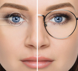 זיהום בתפרים - תמונת אווירה